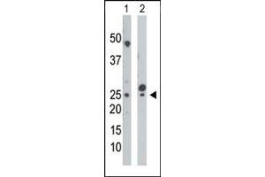 The anti-UCK Pab (ABIN392730 and ABIN2842193) is used in Western blot to detect UCK in mouse cerebellum tissue lysate (Lane 1) and HepG2 cell lysate (Lane 2). (UCK anticorps  (N-Term))