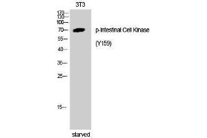 Western Blotting (WB) image for anti-Intestinal Cell (MAK-Like) Kinase (ICK) (pTyr159) antibody (ABIN3182316)