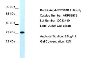 Western Blotting (WB) image for anti-Mitochondrial Ribosomal Protein S18B (MRPS18B) (N-Term) antibody (ABIN2774354) (MRPS18B anticorps  (N-Term))