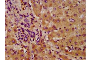 IHC image of ABIN7143530 diluted at 1:600 and staining in paraffin-embedded human liver tissue performed on a Leica BondTM system. (NUDT5 anticorps  (AA 34-166))