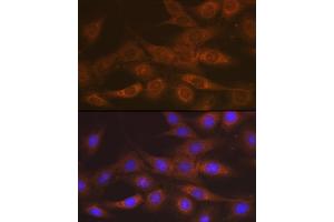 anti-IMP (Inosine 5'-Monophosphate) Dehydrogenase 2 (IMPDH2) antibody