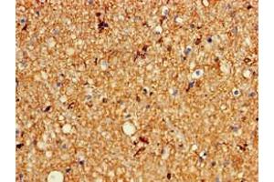 Immunohistochemistry of paraffin-embedded human brain tissue using ABIN7163965 at dilution of 1:100 (KCNC1 anticorps  (AA 1-190))