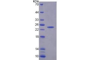 SDS-PAGE analysis of Rat RIPK1 Protein.