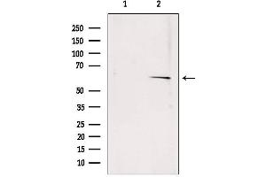 Western blot analysis of extracts from rat muscle, using SQLE antibody.