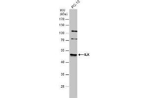 WB Image Whole cell extract (30 μg) was separated by 10% SDS-PAGE, and the membrane was blotted with ILK antibody [N1C1] , diluted at 1:500. (ILK anticorps)