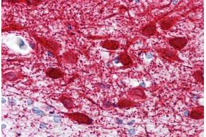 Human Brain, Cortex (formalin-fixed, paraffin-embedded) stained with MAP2 antibody ABIN239820 at 10 ug/ml followed by biotinylated anti-mouse IgG secondary antibody ABIN481714, alkaline phosphatase-streptavidin and chromogen. (MAP2 anticorps  (AA 1375-1395))