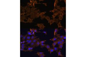 Immunofluorescence analysis of C6 cells using PDGFRB antibody (ABIN3023138, ABIN3023139, ABIN3023140 and ABIN6219408) at dilution of 1:100.