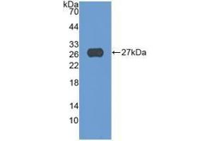 Detection of Recombinant ADAM17, Human using Monoclonal Antibody to A Disintegrin And Metalloprotease 17 (ADAM17) (ADAM17 anticorps  (AA 226-473))