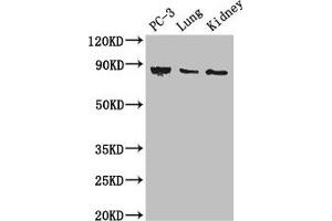 Western Blot Positive WB detected in: PC-3 whole cell lysate, Mouse lung tissue, Mouse kidney tissue All lanes: CARS antibody at 3 μg/mL Secondary Goat polyclonal to rabbit IgG at 1/50000 dilution Predicted band size: 86, 83, 95 kDa Observed band size: 86 kDa (CARS anticorps  (AA 201-500))