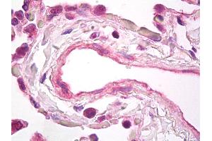 Anti-VEGF antibody IHC of human lung, vascular endothelium. (VEGFA anticorps)