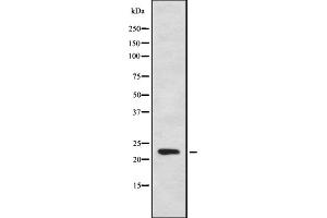 Western blot analysis of CYB561D1 using HeLa whole cell lysates (CYB561D1 anticorps  (C-Term))