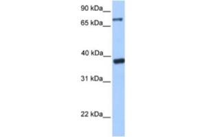 Western Blotting (WB) image for anti-Death Inducer-Obliterator 1 (DIDO1) antibody (ABIN2461923) (DIDO1 anticorps)