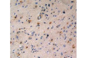 Used in DAB staining on fromalin fixed paraffin- embedded glioma tissue