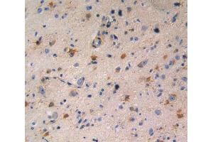 Used in DAB staining on fromalin fixed paraffin- embedded glioma tissue (RENBP anticorps  (AA 1-254))