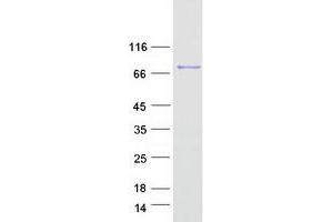 Validation with Western Blot