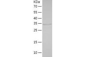 Western Blotting (WB) image for Chondroadherin (CHAD) (AA 23-359) protein (His-IF2DI Tag) (ABIN7122360)