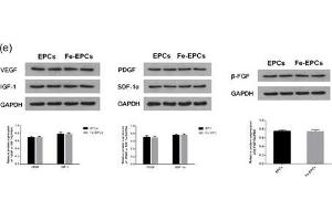 (a) Representative images and bar graphs of the transmigrated cell number in the labeled and unlabeled endothelial progenitor cell (EPC) groups (x200).