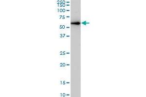 CDK8 monoclonal antibody (M03), clone 5H4. (CDK8 anticorps  (AA 375-464))
