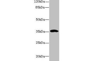 Western blot All lanes: CCDC24 antibody at 6 μg/mL + MCF-7 whole cell lysate Secondary Goat polyclonal to rabbit IgG at 1/10000 dilution Predicted band size: 35, 31 kDa Observed band size: 35 kDa (CCDC24 anticorps  (AA 1-307))
