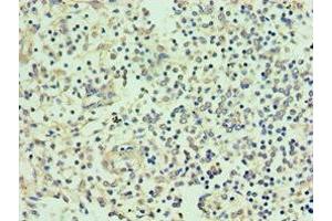 Immunohistochemistry of paraffin-embedded human spleen tissue using ABIN7155522 at dilution of 1:100 (SMYD1 anticorps  (AA 1-350))