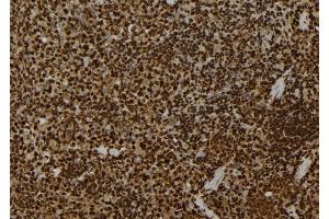 ABIN6272267 at 1/100 staining Mouse spleen tissue by IHC-P. (Casein Kinase 1 gamma 2 anticorps  (C-Term))