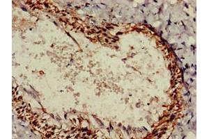 Immunohistochemistry of paraffin-embedded human lung tissue using ABIN7167768 at dilution of 1:100