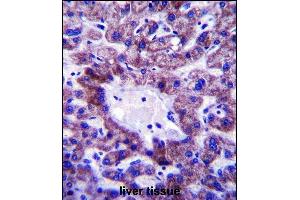 anti-NAD Kinase 2, Mitochondrial (NADK2) (AA 122-150) antibody