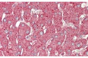 Detection of ANXA4 in Human Liver Tissue using Polyclonal Antibody to Annexin A4 (ANXA4)