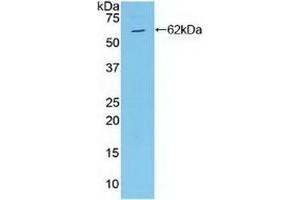 Detection of Recombinant MAP2K4, Human using Polyclonal Antibody to Mitogen Activated Protein Kinase Kinase 4 (MAP2K4) (MAP2K4 anticorps  (AA 137-394))