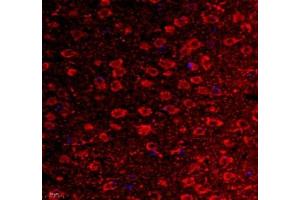 Immunofluorescence of paraffin embedded mouse corpus striatum using VIRL2 (ABIN7076206) at dilution of 1: 700 (400x lens)