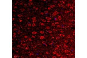 Immunofluorescence of paraffin embedded mouse corpus striatum using VIRL2 (ABIN7076206) at dilution of 1: 700 (400x lens) (VN1R2 anticorps)