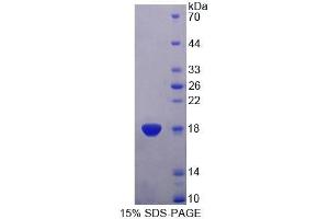 SDS-PAGE (SDS) image for Trafficking Protein Particle Complex 2 (TRAPPC2) (AA 1-140) protein (His tag) (ABIN6239027)
