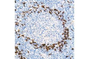Immunohistochemistry of paraffin-embedded Human tonsil using IGHD antibody (ABIN7267824) at dilution of 1:100 (40x lens). (IgD anticorps)