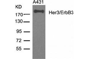 Image no. 3 for anti-Receptor Tyrosine-Protein Kinase ErbB-3 (ERBB3) (AA 1326-1330) antibody (ABIN319384) (ERBB3 anticorps  (AA 1326-1330))
