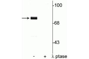 Western blot of rat cortical lysate showing specific immunolabeling of  the ~78 kDa synapsin I phosphorylated at Ser9 in the first lane (-). (SYN1 anticorps  (pSer9))