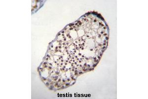 anti-Testis Specific, 10 Interacting Protein (TSGA10IP) (AA 499-528), (C-Term) antibody