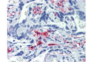 Anti-CD163 antibody IHC of human placenta. (CD163 anticorps)