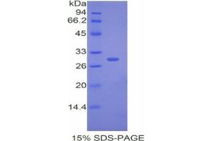 SDS-PAGE analysis of Rabbit CETP Protein. (CETP Protéine)