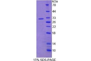 Image no. 1 for ADAM Metallopeptidase Domain 12 (ADAM12) (AA 513-767) protein (His tag) (ABIN6237285)