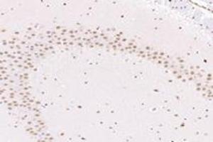 Immunohistochemistry analysis of paraffin-embedded mouse substantia nigra using NUP133 (ABIN7074909) at dilution of 1: 4800