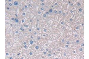 Detection of PAP in Human Liver Tissue using Polyclonal Antibody to Prostatic Acid Phosphatase (PAP) (ACPP anticorps  (AA 217-386))