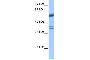 Coilin antibody used at 1 ug/ml to detect target protein. (Coilin anticorps  (C-Term))