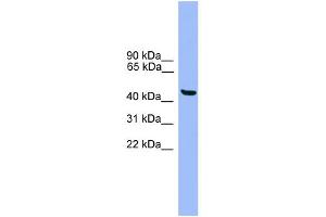 WB Suggested Anti-GTF2A1L Antibody Titration: 0. (GTF2A1L anticorps  (C-Term))