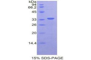 SDS-PAGE (SDS) image for CD163 (CD163) (AA 697-972) protein (His tag) (ABIN1878228)
