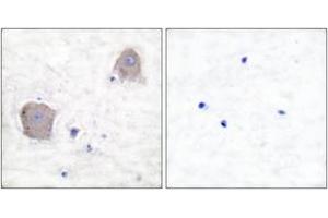 Immunohistochemistry analysis of paraffin-embedded human brain tissue, using mGluR4 Antibody. (Metabotropic Glutamate Receptor 4 anticorps  (AA 851-900))
