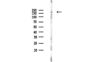 anti-Tight Junction Protein 1 (TJP1) (Internal Region) antibody