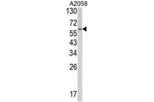 Western blot analysis of SCP2 Antibody (Center) in A2058 cell line lysates (35ug/lane). (SCP2 anticorps  (Middle Region))