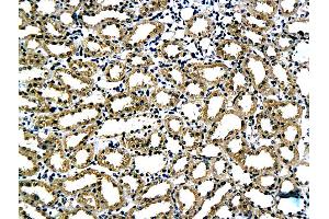 Formalin-fixed and paraffin embedded rat kidney tissue labeled with Anti-Laminin alpha 5 Polyclonal Antibody, Unconjugated (ABIN737451) followed by conjugation to the secondary antibody and DAB staining (Laminin alpha 5 anticorps  (AA 301-400))
