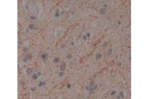 IHC-P analysis of Human Tissue, with DAB staining. (TWF1 anticorps  (AA 1-252))