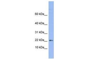 Image no. 1 for anti-Ribosomal Protein S24 (RPS24) (AA 71-120) antibody (ABIN6742964) (RPS24 anticorps  (AA 71-120))
